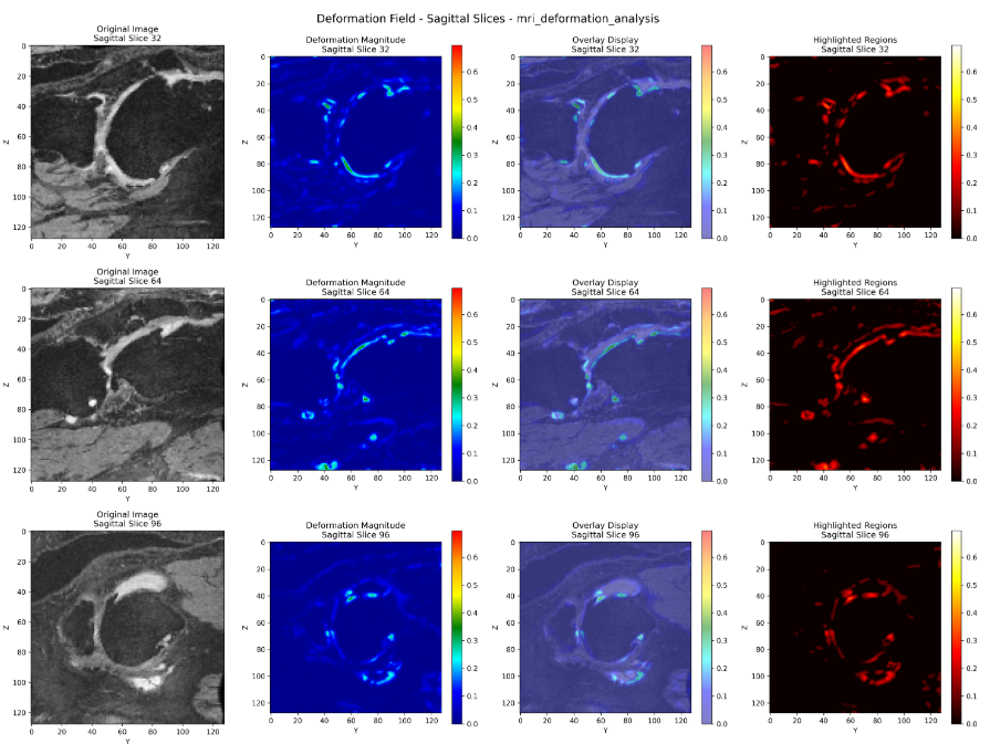 OAI 膝关节 MRI 验证